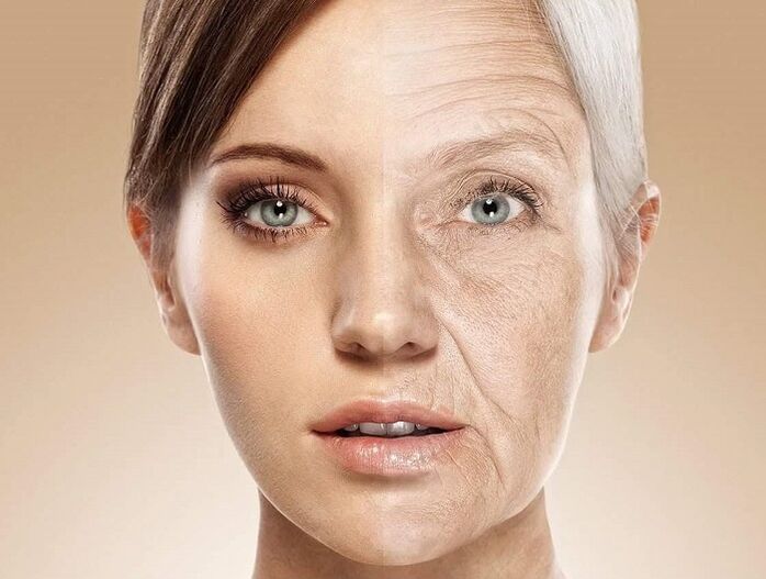 پوست صورت قبل و بعد از جوان سازی با لیزر